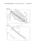 BIDIRECTIONAL SELF-RETAINING SUTURES WITH LASER-MARKED AND/OR NON-LASER     MARKED INDICIA AND METHODS diagram and image