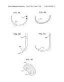 BIDIRECTIONAL SELF-RETAINING SUTURES WITH LASER-MARKED AND/OR NON-LASER     MARKED INDICIA AND METHODS diagram and image