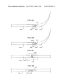 BIDIRECTIONAL SELF-RETAINING SUTURES WITH LASER-MARKED AND/OR NON-LASER     MARKED INDICIA AND METHODS diagram and image