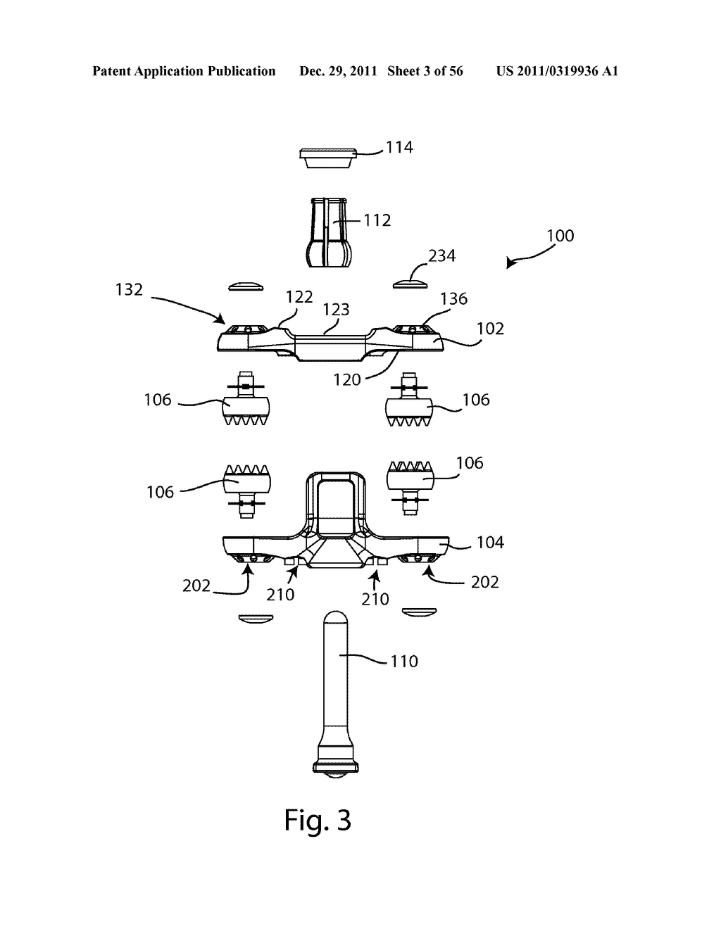 SPINOUS PROCESS FUSION IMPLANTS AND INSERTION, COMPRESSION, AND LOCKING     INSTRUMENTATION - diagram, schematic, and image 04