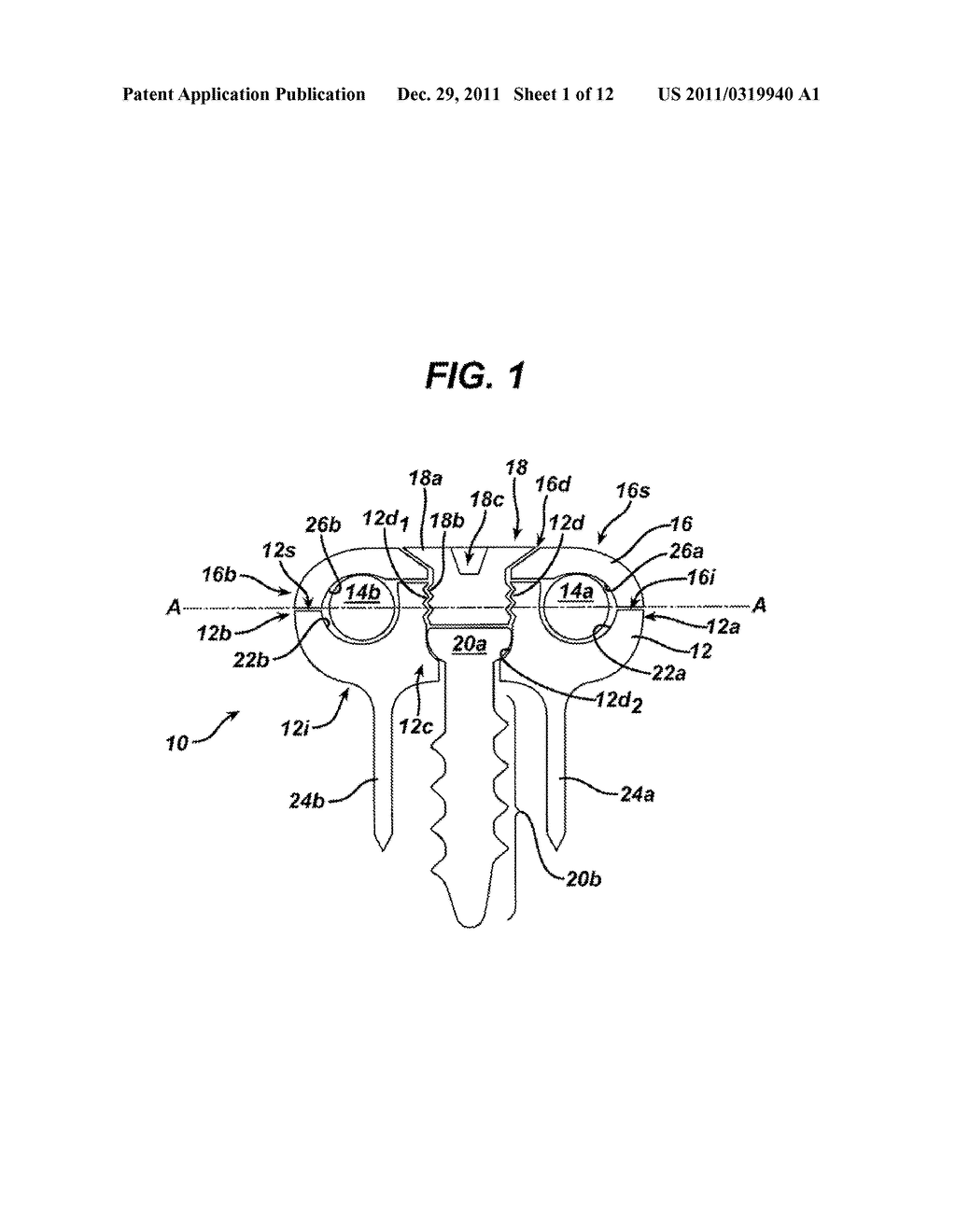 NON-FUSION SPINAL CORRECTION SYSTEMS AND METHODS - diagram, schematic, and image 02