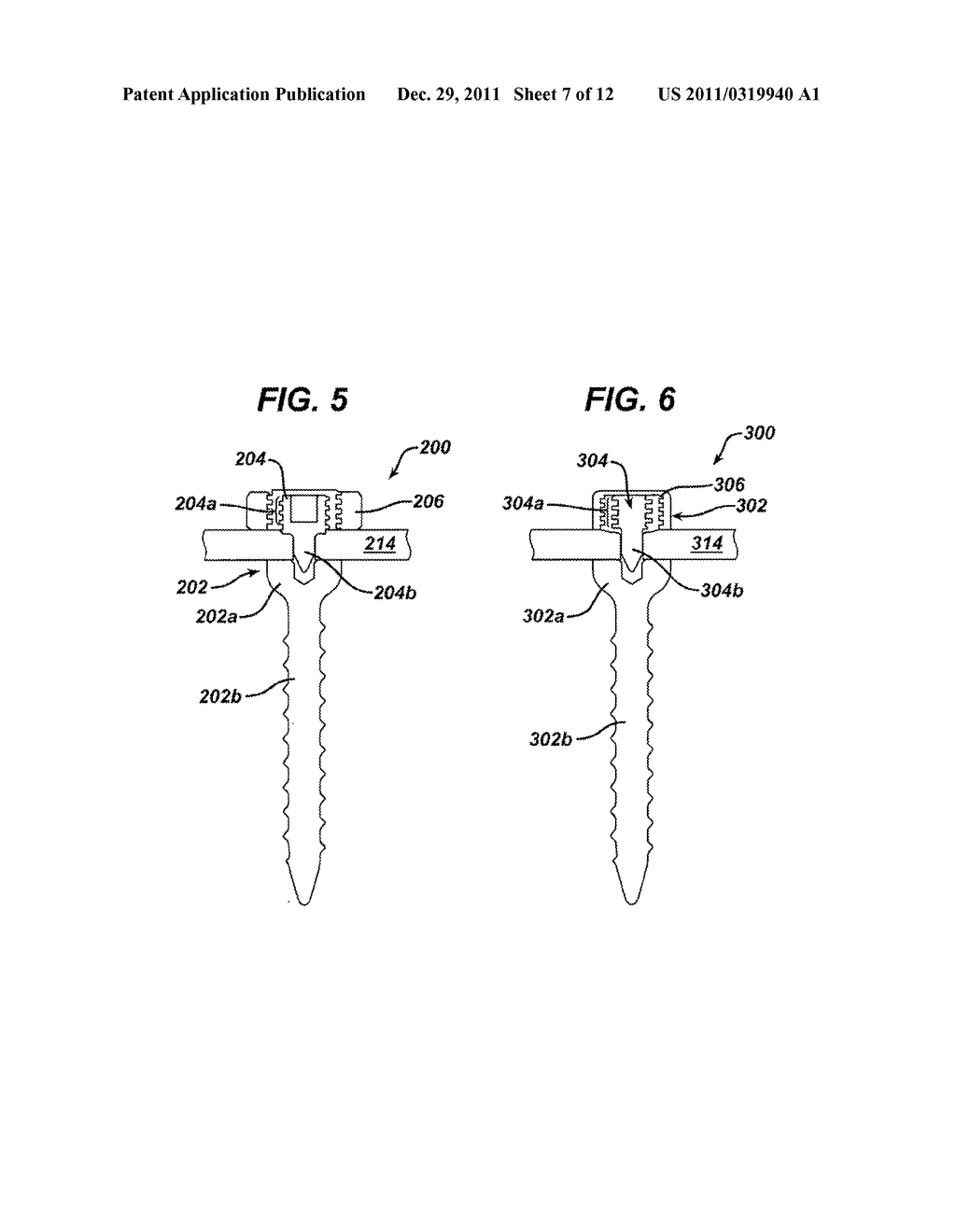 NON-FUSION SPINAL CORRECTION SYSTEMS AND METHODS - diagram, schematic, and image 08