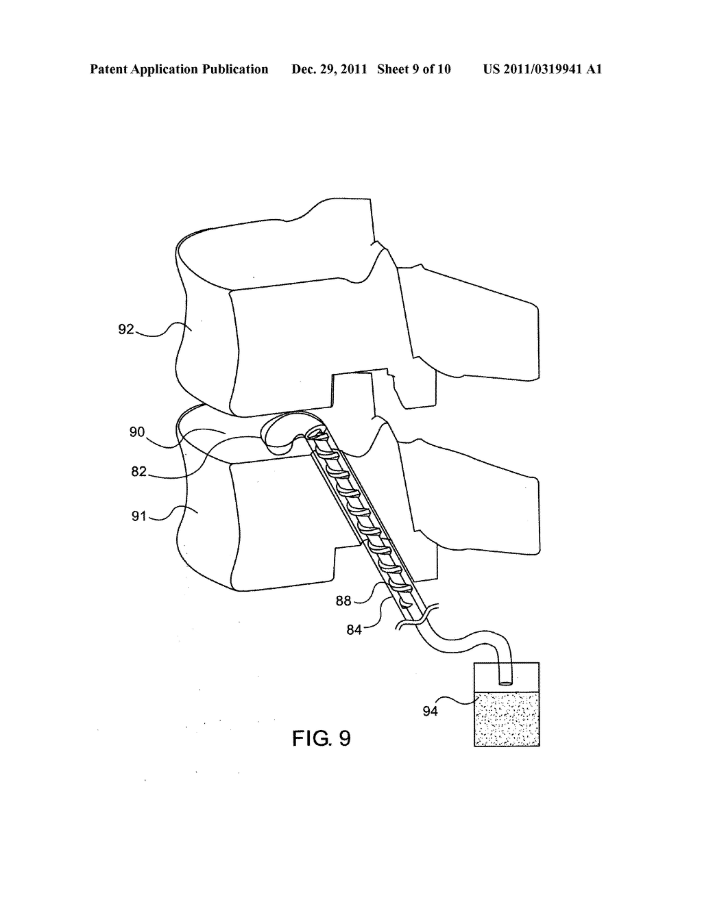 Robot Guided Oblique Spinal Stabilization - diagram, schematic, and image 10