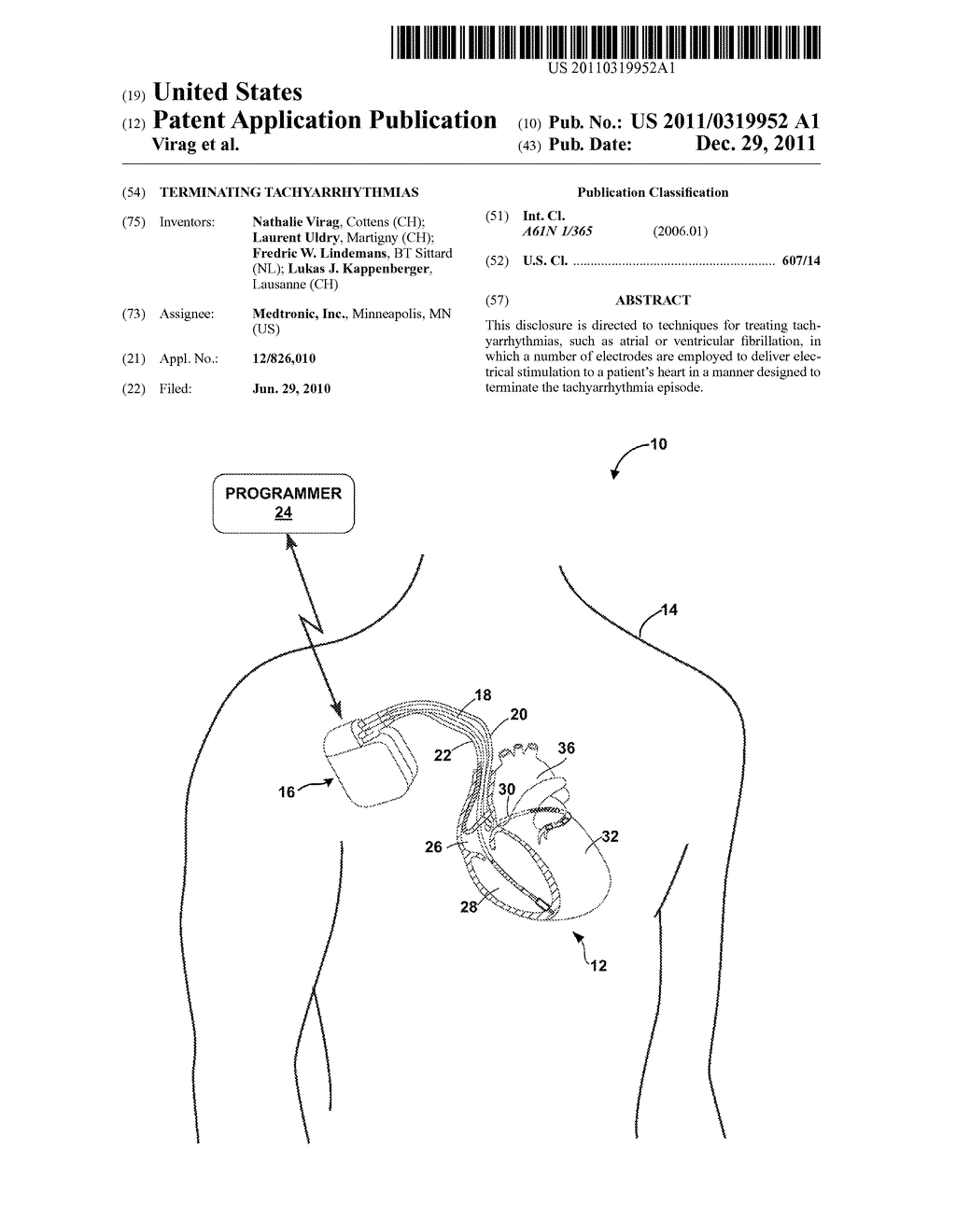 TERMINATING TACHYARRHYTHMIAS - diagram, schematic, and image 01