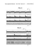 NON-INVASIVE TREATMENT OF BRONCHIAL CONSTRICTION diagram and image