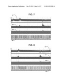 NON-INVASIVE TREATMENT OF BRONCHIAL CONSTRICTION diagram and image