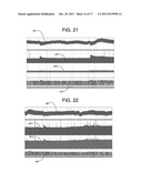 NON-INVASIVE TREATMENT OF BRONCHIAL CONSTRICTION diagram and image