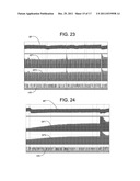 NON-INVASIVE TREATMENT OF BRONCHIAL CONSTRICTION diagram and image