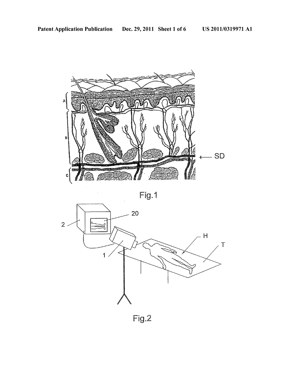 METHOD AND CONTROL SYSTEM FOR A TREATMENT BY SUBCUTANEOUS OR     INTRACUTANEOUS IRRADIATION BY MEANS OF ELECTROMAGNETIC RADIATION - diagram, schematic, and image 02