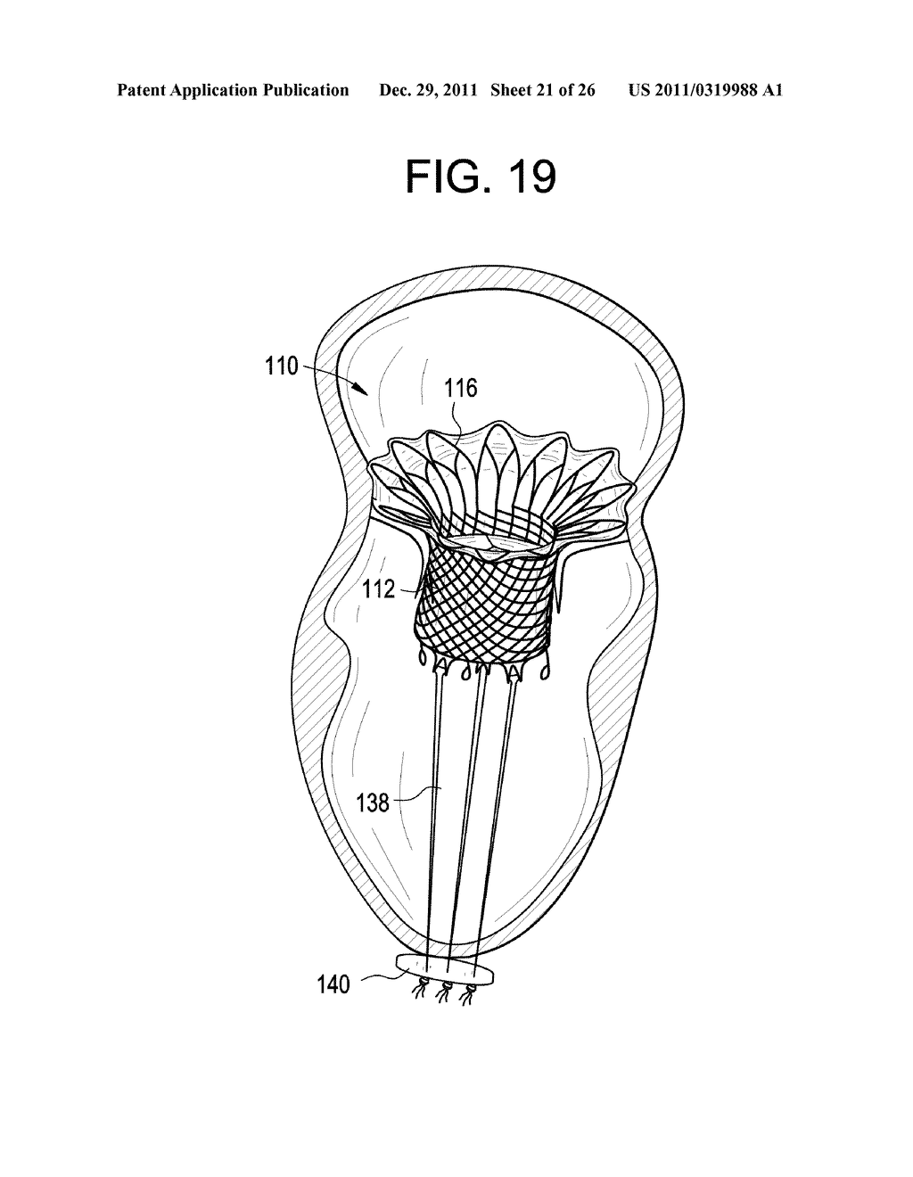 Device and System for Transcatheter Mitral Valve Replacement - diagram, schematic, and image 22