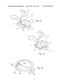 DEVICES, SYSTEMS, AND METHODS FOR SUPPLEMENTING, REPAIRING OR REPLACING A     NATIVE HEART VALVE LEAFLET diagram and image