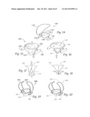 DEVICES, SYSTEMS, AND METHODS FOR SUPPLEMENTING, REPAIRING OR REPLACING A     NATIVE HEART VALVE LEAFLET diagram and image