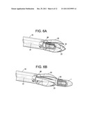 Enhanced Cage Insertion Device diagram and image