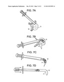 Enhanced Cage Insertion Device diagram and image