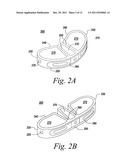 SPINAL FUSION IMPLANT diagram and image