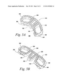 SPINAL FUSION IMPLANT diagram and image