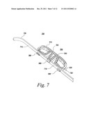 SPINAL FUSION IMPLANT diagram and image