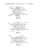 Artificial Spinal Disc diagram and image