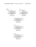 Artificial Spinal Disc diagram and image