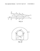 Artificial Spinal Disc diagram and image