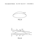 Artificial Spinal Disc diagram and image