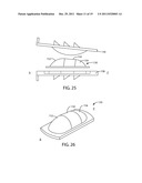 Artificial Spinal Disc diagram and image