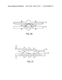 Artificial Spinal Disc diagram and image