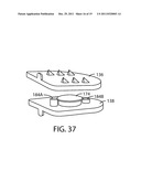 Artificial Spinal Disc diagram and image