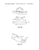 Artificial Spinal Disc diagram and image