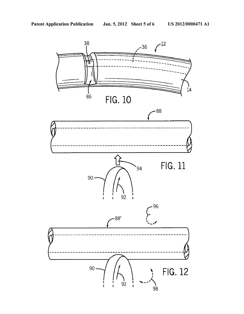 TRACHEAL TUBES WITH IMPROVED SECRETION REMOVAL SYSTEMS - diagram, schematic, and image 06