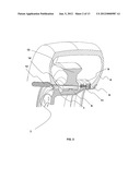 Expandable Single and Dual Bead Locking Device diagram and image