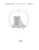 Expandable Single and Dual Bead Locking Device diagram and image