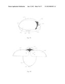 Multi-screen personal communication device diagram and image