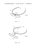 INNOVATIVE AND AESTHETIC ALTERNATIVE TO TRADITIONAL SPECTACLE CORRECTION     THAT OBVIATES THE NOSE/NASAL BRIDGE AND EARS FOR PLACEMENT diagram and image