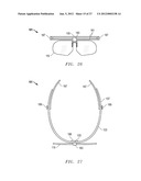 INNOVATIVE AND AESTHETIC ALTERNATIVE TO TRADITIONAL SPECTACLE CORRECTION     THAT OBVIATES THE NOSE/NASAL BRIDGE AND EARS FOR PLACEMENT diagram and image