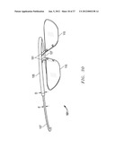 INNOVATIVE AND AESTHETIC ALTERNATIVE TO TRADITIONAL SPECTACLE CORRECTION     THAT OBVIATES THE NOSE/NASAL BRIDGE AND EARS FOR PLACEMENT diagram and image