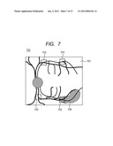 OPHTHALMOLOGIC APPARATUS AND OPHTHALMOLOGIC SYSTEM diagram and image