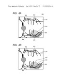 OPHTHALMOLOGIC APPARATUS AND OPHTHALMOLOGIC SYSTEM diagram and image