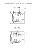 OPHTHALMOLOGIC APPARATUS AND OPHTHALMOLOGIC SYSTEM diagram and image