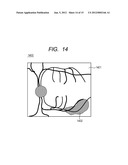 OPHTHALMOLOGIC APPARATUS AND OPHTHALMOLOGIC SYSTEM diagram and image