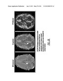 DENDRIMER BASED NANODEVICES FOR THERAPEUTIC AND IMAGING PURPOSES diagram and image