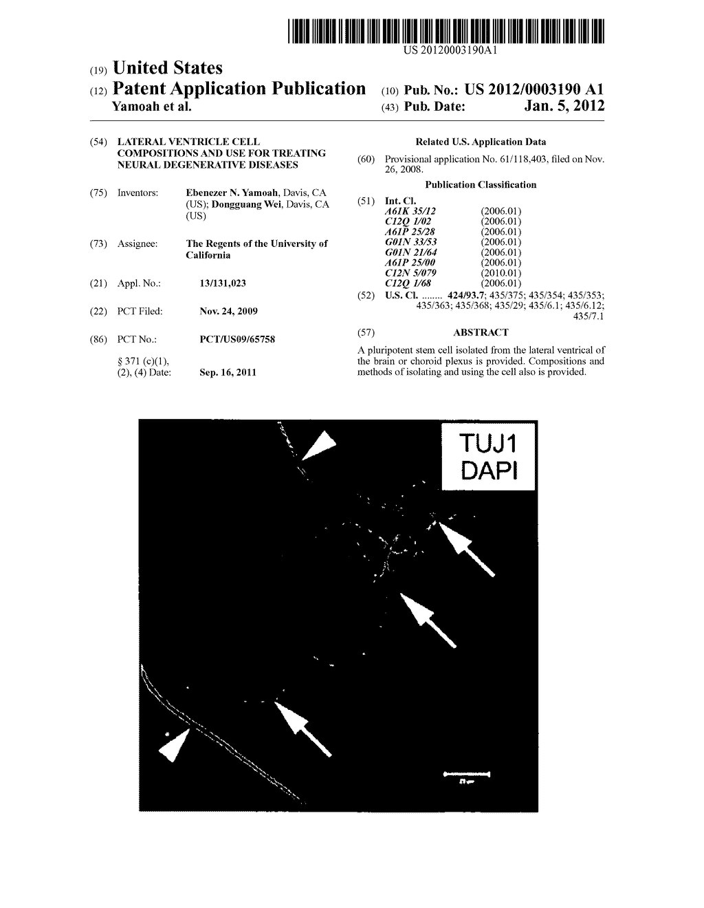 LATERAL VENTRICLE CELL COMPOSITIONS AND USE FOR TREATING NEURAL     DEGENERATIVE DISEASES - diagram, schematic, and image 01