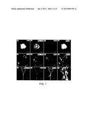 LATERAL VENTRICLE CELL COMPOSITIONS AND USE FOR TREATING NEURAL     DEGENERATIVE DISEASES diagram and image