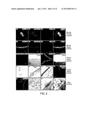 LATERAL VENTRICLE CELL COMPOSITIONS AND USE FOR TREATING NEURAL     DEGENERATIVE DISEASES diagram and image