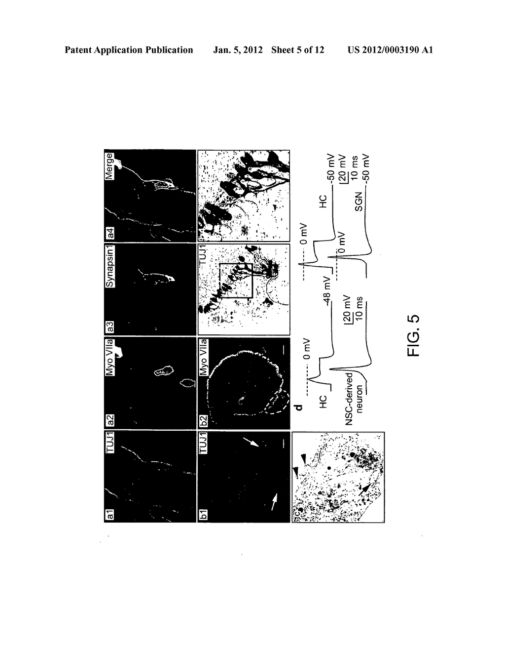 LATERAL VENTRICLE CELL COMPOSITIONS AND USE FOR TREATING NEURAL     DEGENERATIVE DISEASES - diagram, schematic, and image 06