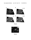 LATERAL VENTRICLE CELL COMPOSITIONS AND USE FOR TREATING NEURAL     DEGENERATIVE DISEASES diagram and image