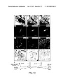 LATERAL VENTRICLE CELL COMPOSITIONS AND USE FOR TREATING NEURAL     DEGENERATIVE DISEASES diagram and image