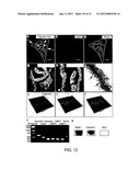 LATERAL VENTRICLE CELL COMPOSITIONS AND USE FOR TREATING NEURAL     DEGENERATIVE DISEASES diagram and image