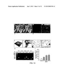 LATERAL VENTRICLE CELL COMPOSITIONS AND USE FOR TREATING NEURAL     DEGENERATIVE DISEASES diagram and image