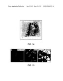 LATERAL VENTRICLE CELL COMPOSITIONS AND USE FOR TREATING NEURAL     DEGENERATIVE DISEASES diagram and image